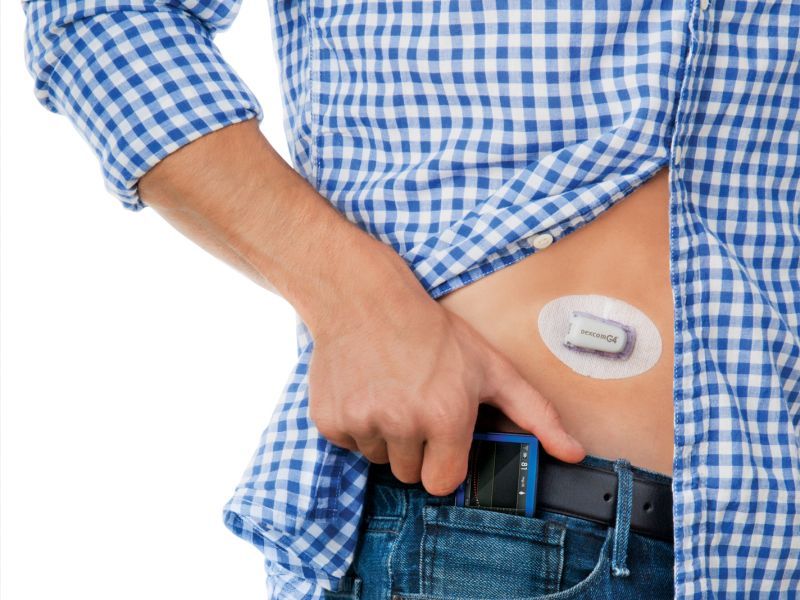 high-tech-blood-sugar-monitors-may-help-people-with-type-1-diabetes